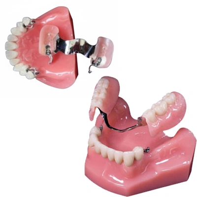 Precision-Attachment Dentures