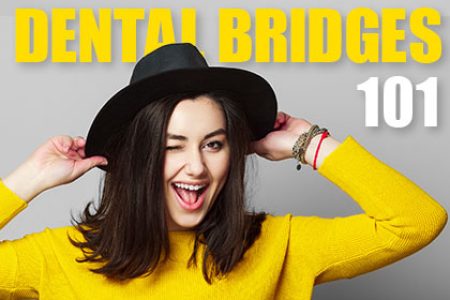 Dental Bridges 101 (featured image)
