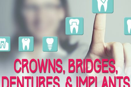 Crowns, Bridges, Dentures, and Implants: The Facts (featured image)