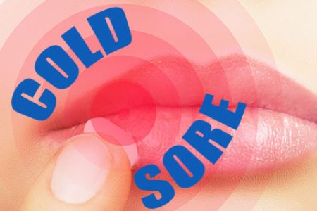 Do I Have Herpes? Cold Sores 101 (featured image)