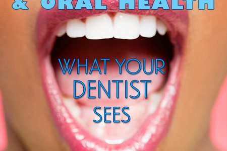 Diabetes & Oral Health: What Your Dentist Sees (featured image)