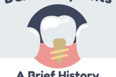 Dental Implants: A Brief History of Tooth Replacement Innovation (featured image)