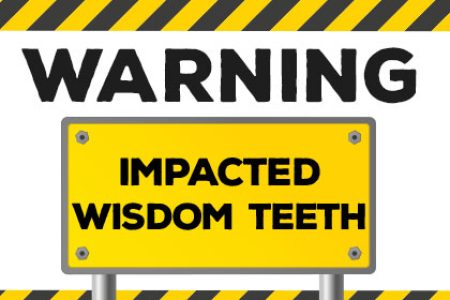 Warning Signs of Impacted Wisdom Teeth (featured image)