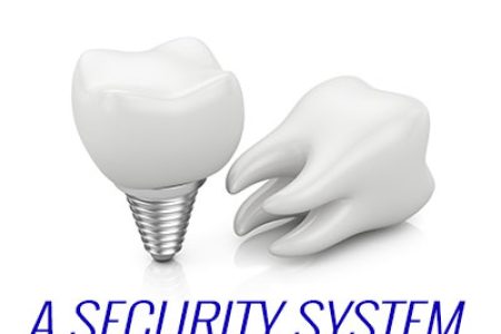 Dental Implants – A Security System for Your Smile (featured image)