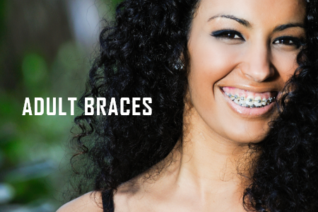 A Few Quick Tips to Help You Find the Best Adult Braces (featured image)
