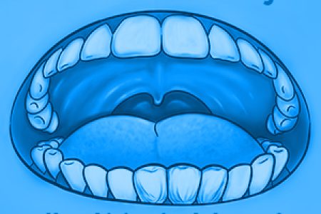 Should I Be Screening Myself for Oral Cancer? (featured image)