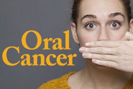 Oral Cancer – Prevention & Early Detection (featured image)