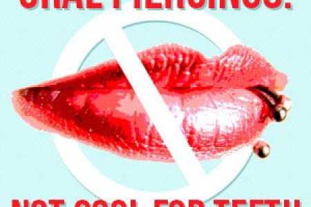 Oral Piercings: Not Cool for Teeth (featured image)