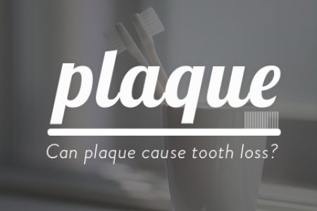 Can Plaque Cause Tooth Loss? (featured image)