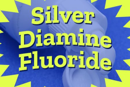 Silver Diamine Fluoride: An Affordable Filling Alternative (featured image)