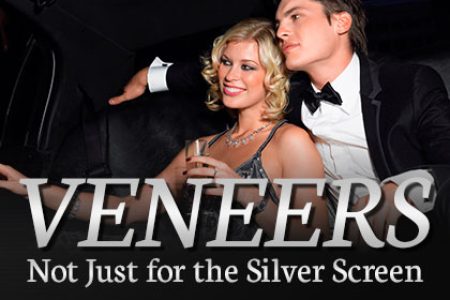 Veneers – Not Just for the Silver Screen (featured image)