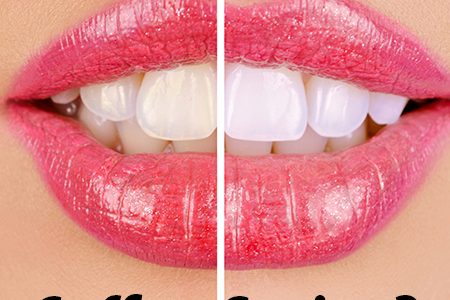 Are Your Teeth Safe from Coffee Stains? (featured image)