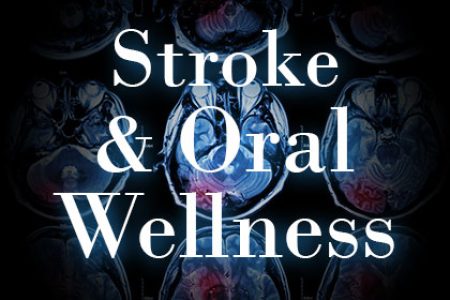 Don’t Have a Stroke – Your Dentist Can Help (featured image)