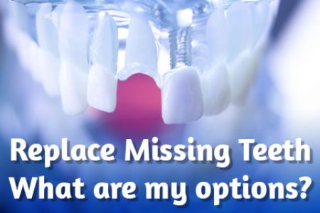 Filling in the Gaps: Restoring Your Smile & Quality of Life (featured image)