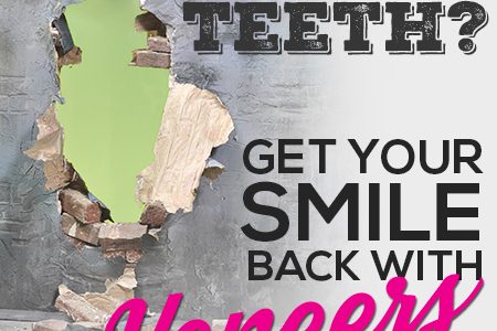 Veneers Can Give You Back Your Smile! (featured image)