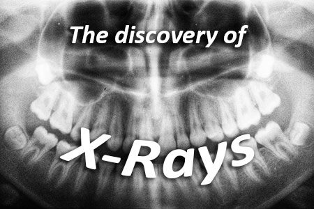 The Discovery of X-Rays (featured image)