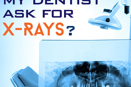 The Importance of Dental X-Rays (featured image)